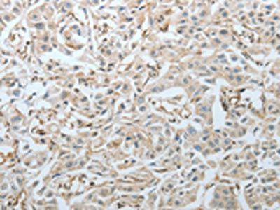CRMP1 Antibody
