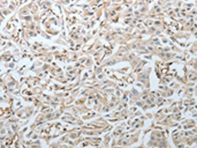 CRMP1 antibody