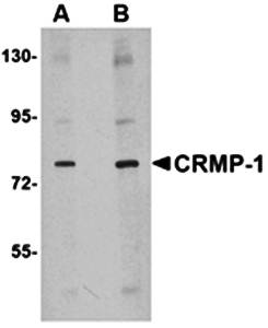 CRMP1 Antibody