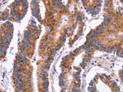 CROT Antibody