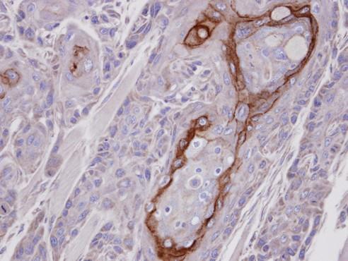 CROT antibody [N2C2], Internal