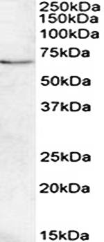 Goat anti-Crot (rat) (aa178-199) Antibody