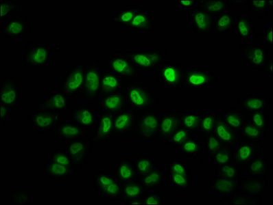 Crotonyl-HIST1H2BC (K11) Antibody