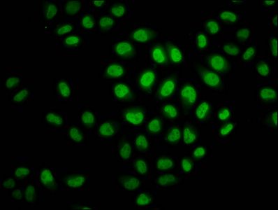 Crotonyl-HIST1H2BC (K23) Antibody