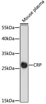 CRP antibody