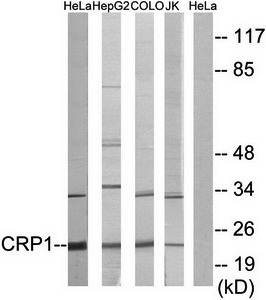 CRP1 Antibody