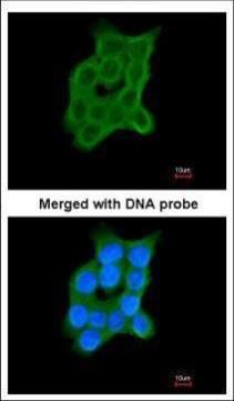 CRTAP Rabbit Polyclonal Antibody
