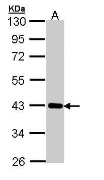 CRTAP Rabbit Polyclonal Antibody