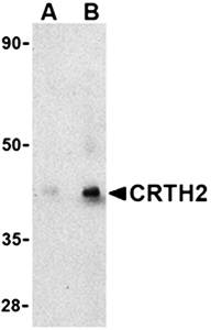 CRTH2 Antibody