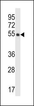CRTRT1 antibody