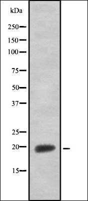 CRYAB antibody