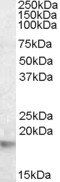 CRYAB antibody