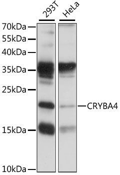 CRYBA4 antibody