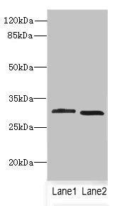 CRYBB1 antibody