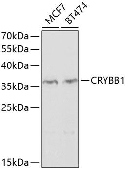 CRYBB1 antibody