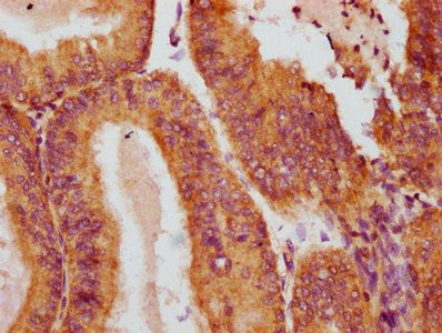 CRYZ Antibody