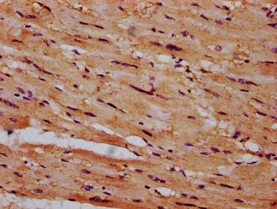 CSAD Antibody