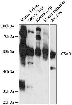 CSAD antibody