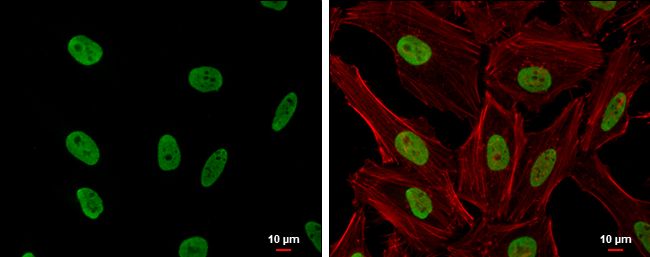 CSB antibody [N2C1], Internal
