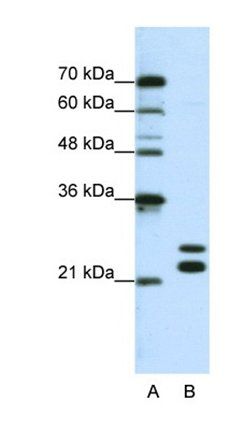 CSDC2 antibody
