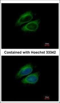 CSDE1 Rabbit Polyclonal Antibody