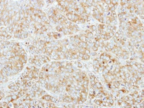 CSDE1 Rabbit Polyclonal Antibody