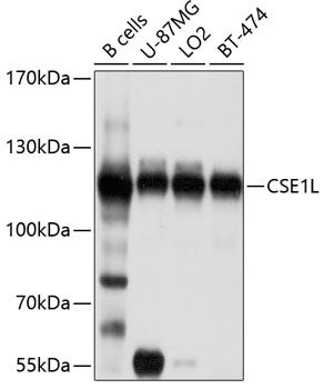 CSE1L antibody