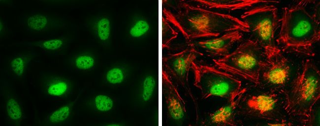 CSE1L antibody