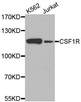 CSF1R antibody