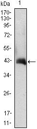 CSF2 Antibody