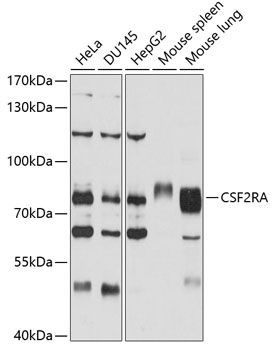 CSF2RA antibody