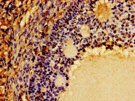 CSF2RB Antibody