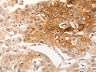 CSF3R Antibody