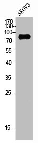 CSF3R antibody