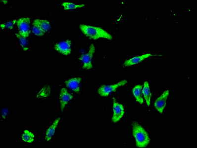 CSF3R antibody