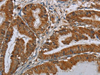 CSH1 Antibody