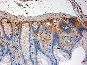 Goat anti-CSK Antibody