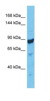CSKP antibody