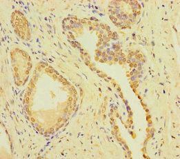 CSMD2 antibody