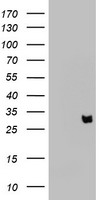 CSMD3 antibody