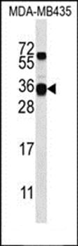 CSN2 antibody