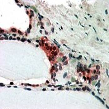 Goat anti-CSN2 / TRIP15 Antibody