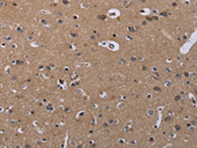 CSNK1A1 Antibody