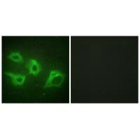 CSNK1A1 Antibody