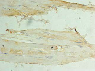 CSNK1D Antibody