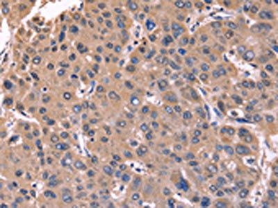 CSNK1D Antibody