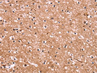 CSNK1D Antibody