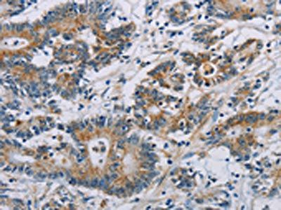 CSNK1E Antibody