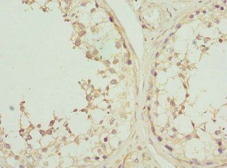 CSNK1G2 Antibody
