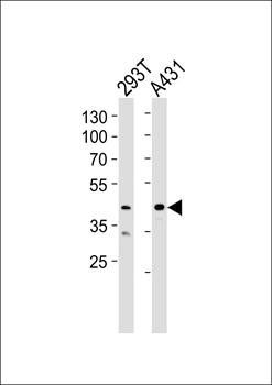 CSNK2A1 antibody